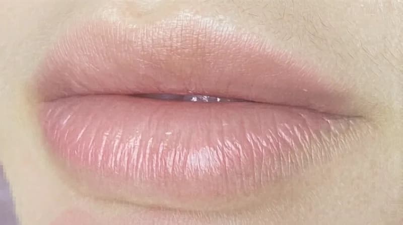 Antes del tratamiento de Micropigmentación de labios en AB Clínica, Castellón de la Plana